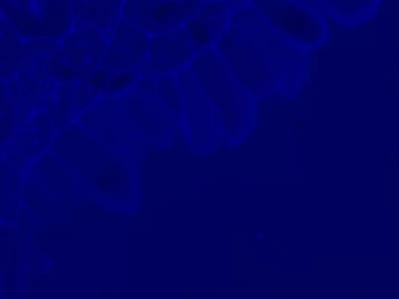 Zeiss AXIO Examiner.Z1 Fluorescence Water Immersion Capable Motorized Microscope