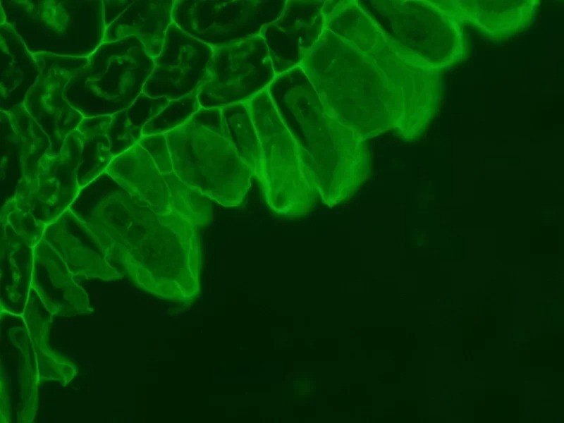 Zeiss AXIO Examiner.Z1 Fluorescence Water Immersion Capable Motorized Microscope