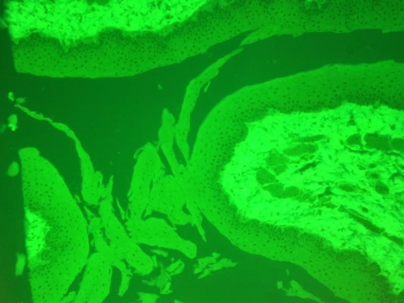 Nikon Eclipse 80i Upright Fluorescence Microscope (New Filters)