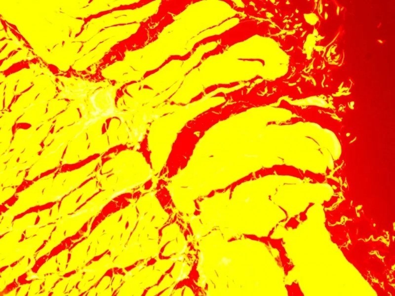 Nikon Eclipse TE2000-E Inverted Fluorescence Motorized Microscope