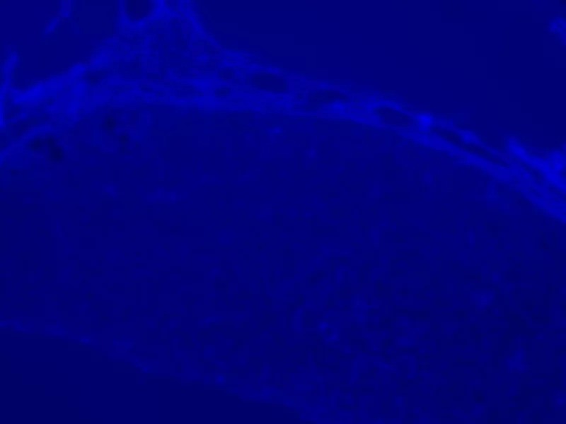 Nikon Eclipse TI-E PFS Inverted LED Fluorescence DIC Motorized Microscope with Motorized Stage