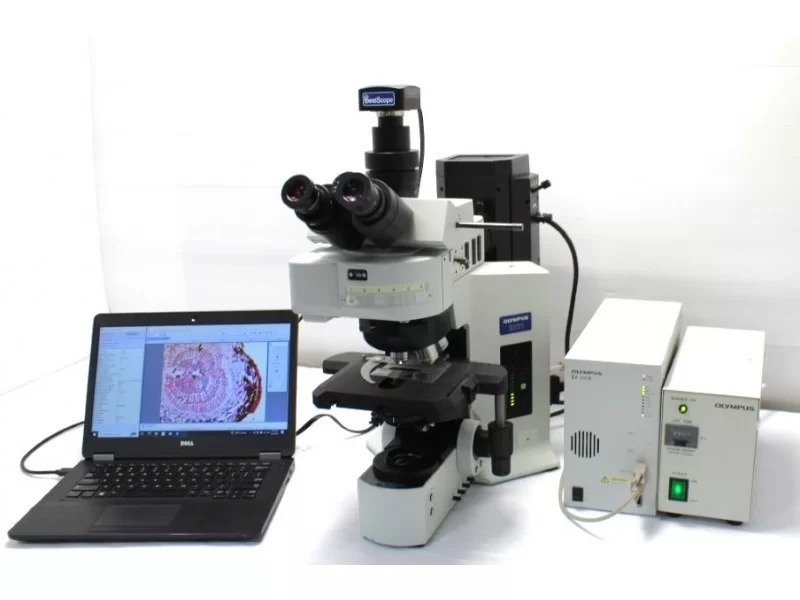 Olympus BX61 Fluorescence Motorized Microscope (New Filters) Pred BX63