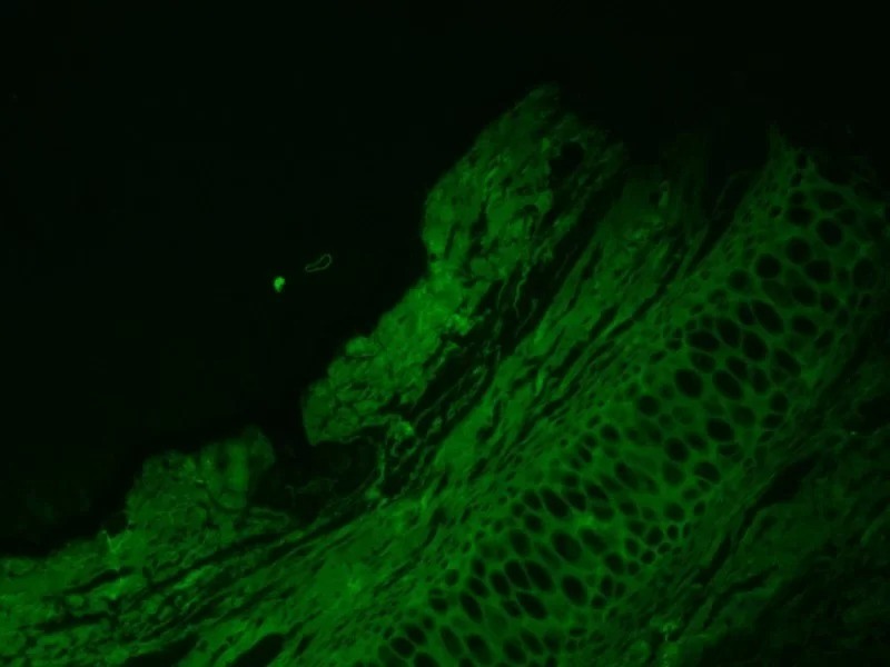 Zeiss AXIO Observer 7 Inverted LED Fluorescence Phase Contrast Motorized XY Microscope (New Filters)