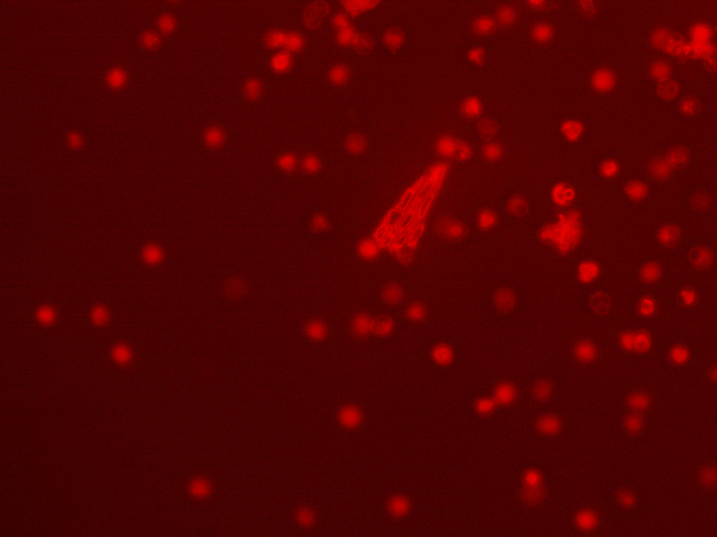 Zeiss AXIO Imager 2 Imager.D2 LED Fluorescence Phase Contrast Microscope