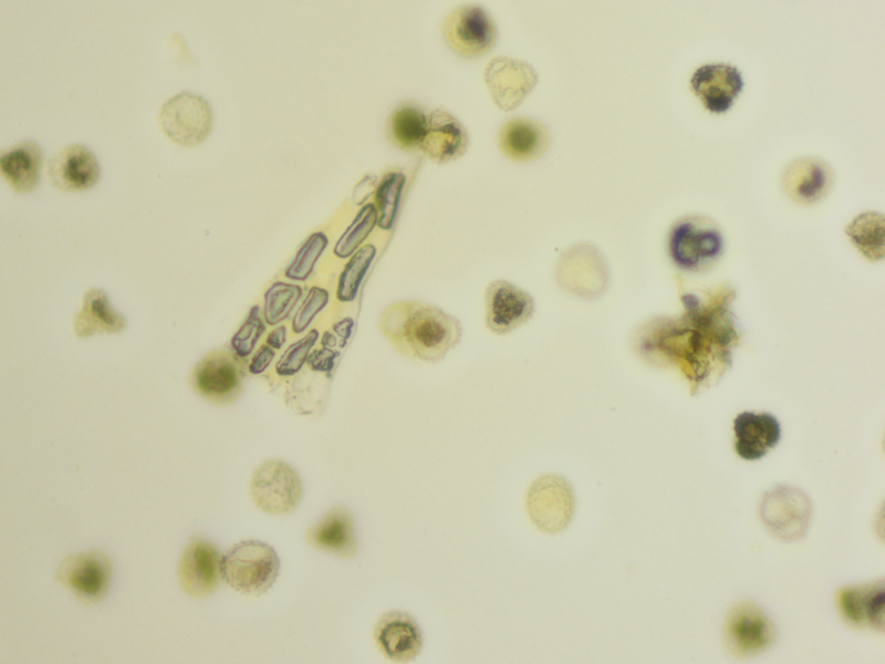 Zeiss AXIO Imager 2 Imager.D2 LED Fluorescence Phase Contrast Microscope