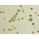 Zeiss AXIO Imager 2 Imager.D2 LED Fluorescence Phase Contrast Microscope