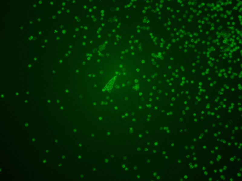 Zeiss AXIO Imager 2 Imager.D2 LED Fluorescence Phase Contrast Microscope