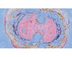 Zeiss Axio Vert.A1 Inverted Fluorescence LED Phase Contrast Microscope (New Filters) Pred Axiovert 5/7