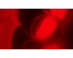 Olympus BX51WI BX51 Electrophysiology Rig Fluorescence Microscope w/ AxoPatch 200B, CV-203BU Headstage, TMC Anti-Vibration Table (New Filters)